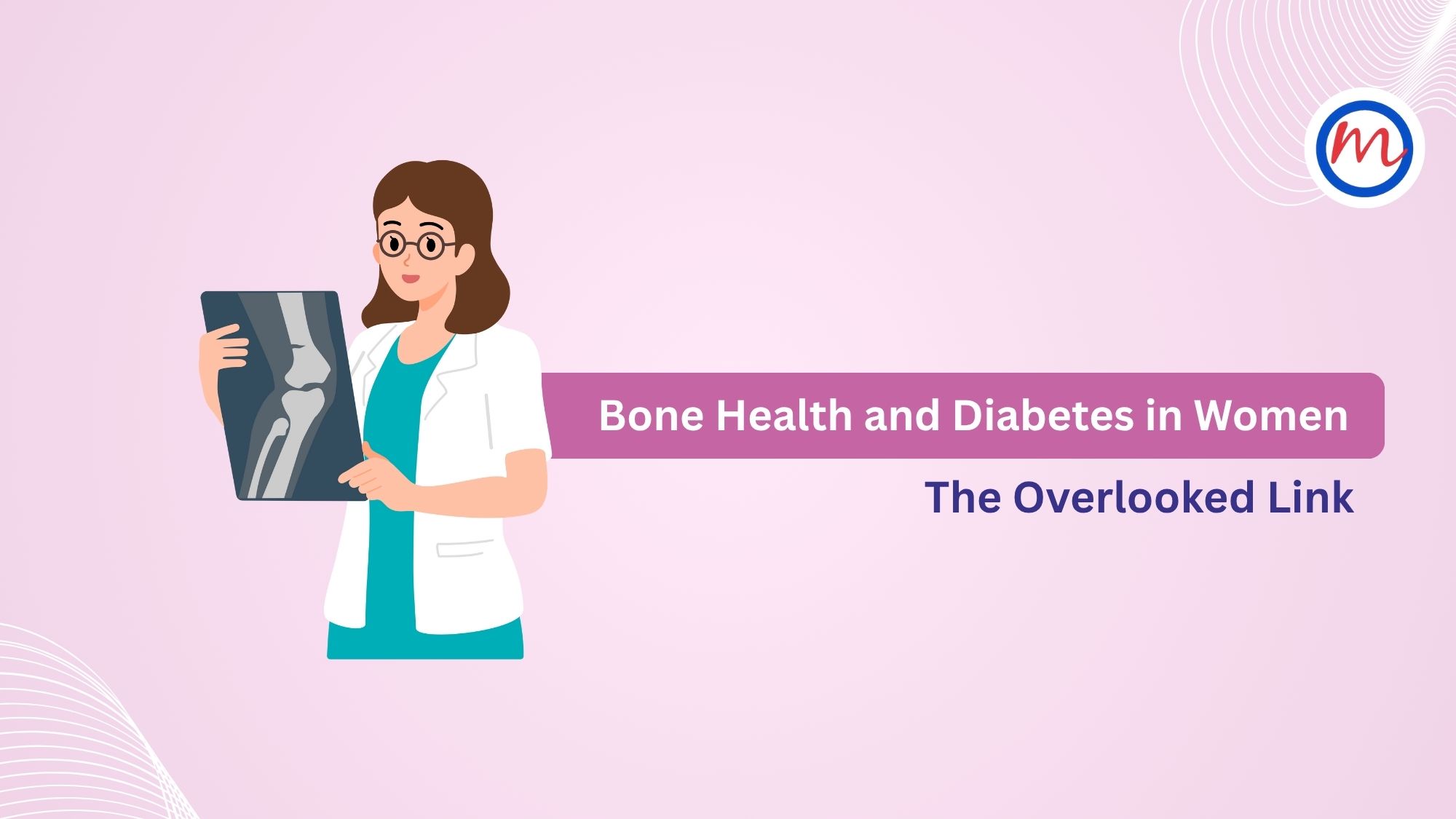  Bone Health and Diabetes in Women: The Overlooked Link