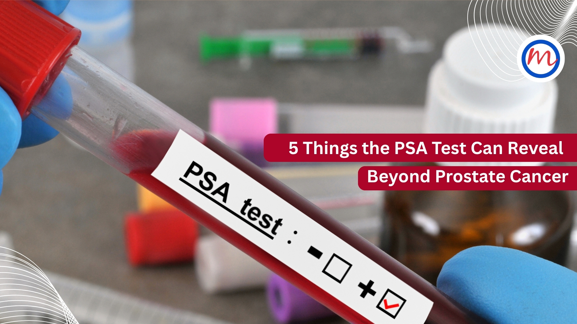 PSA Test