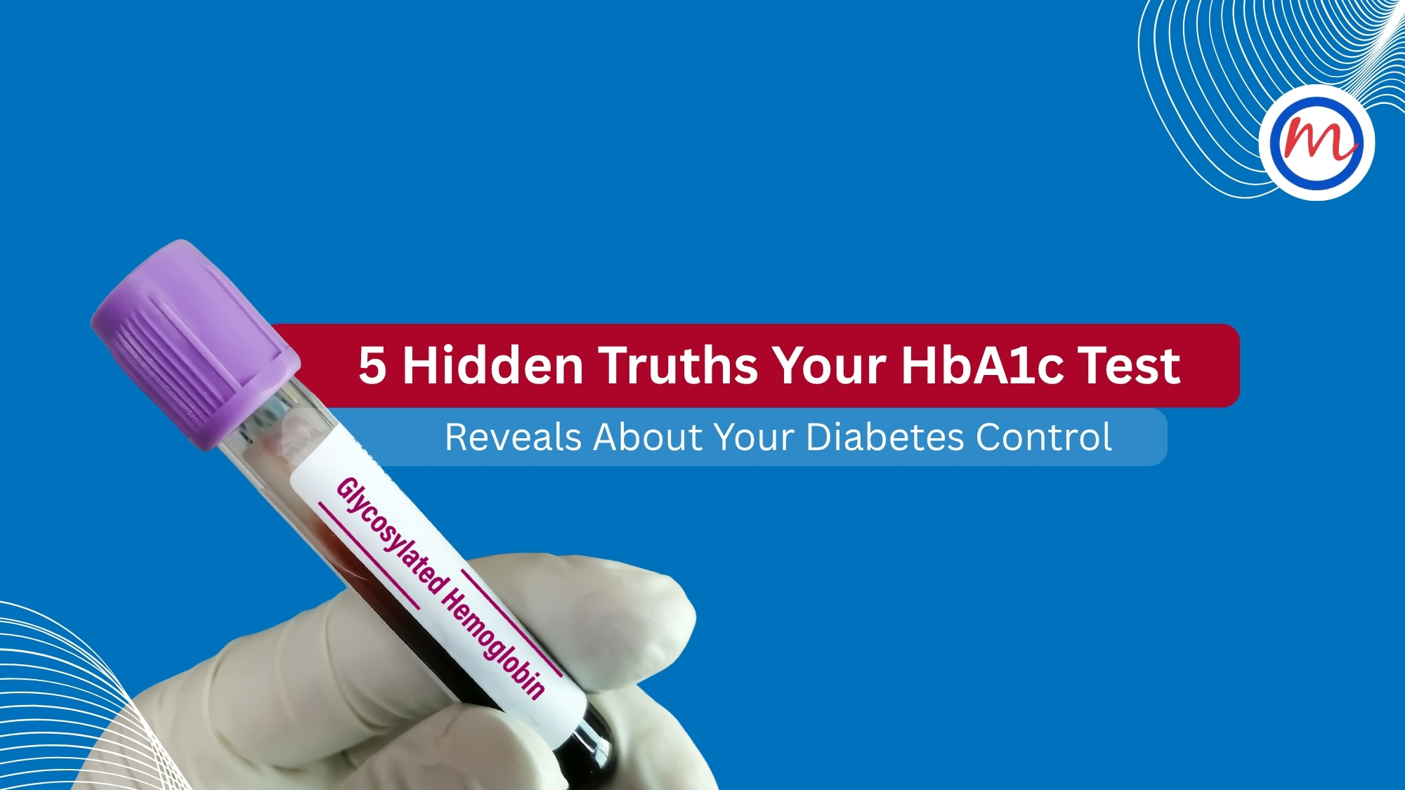 HbA1c Test