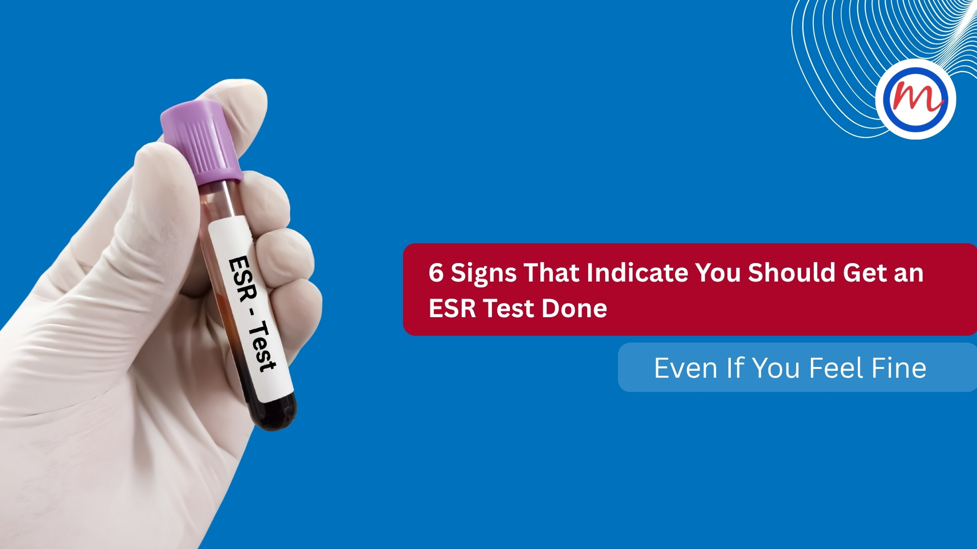 ESR Test