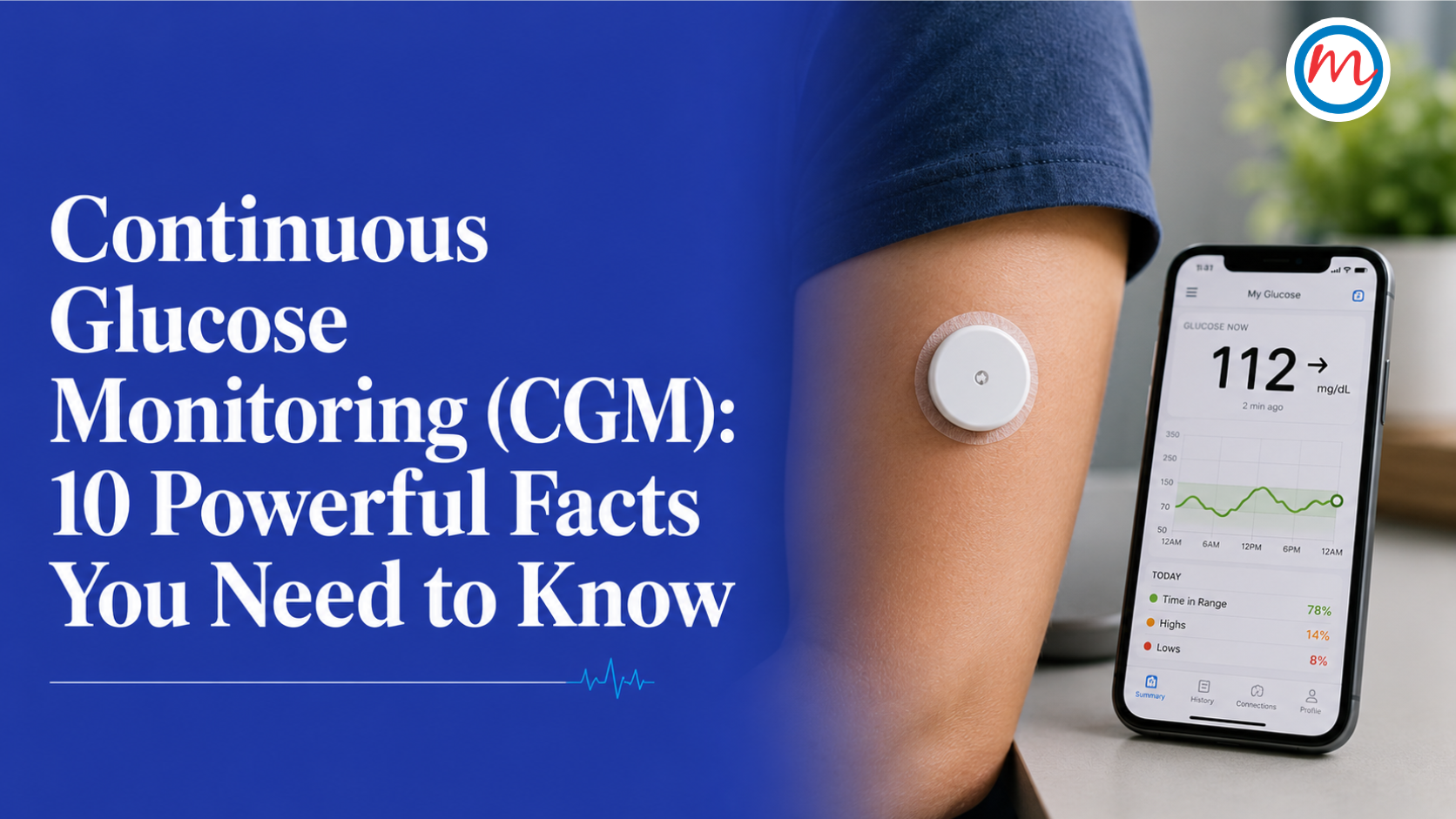 Continuous Glucose Monitoring (CGM): 10 Powerful Facts You Need to Know